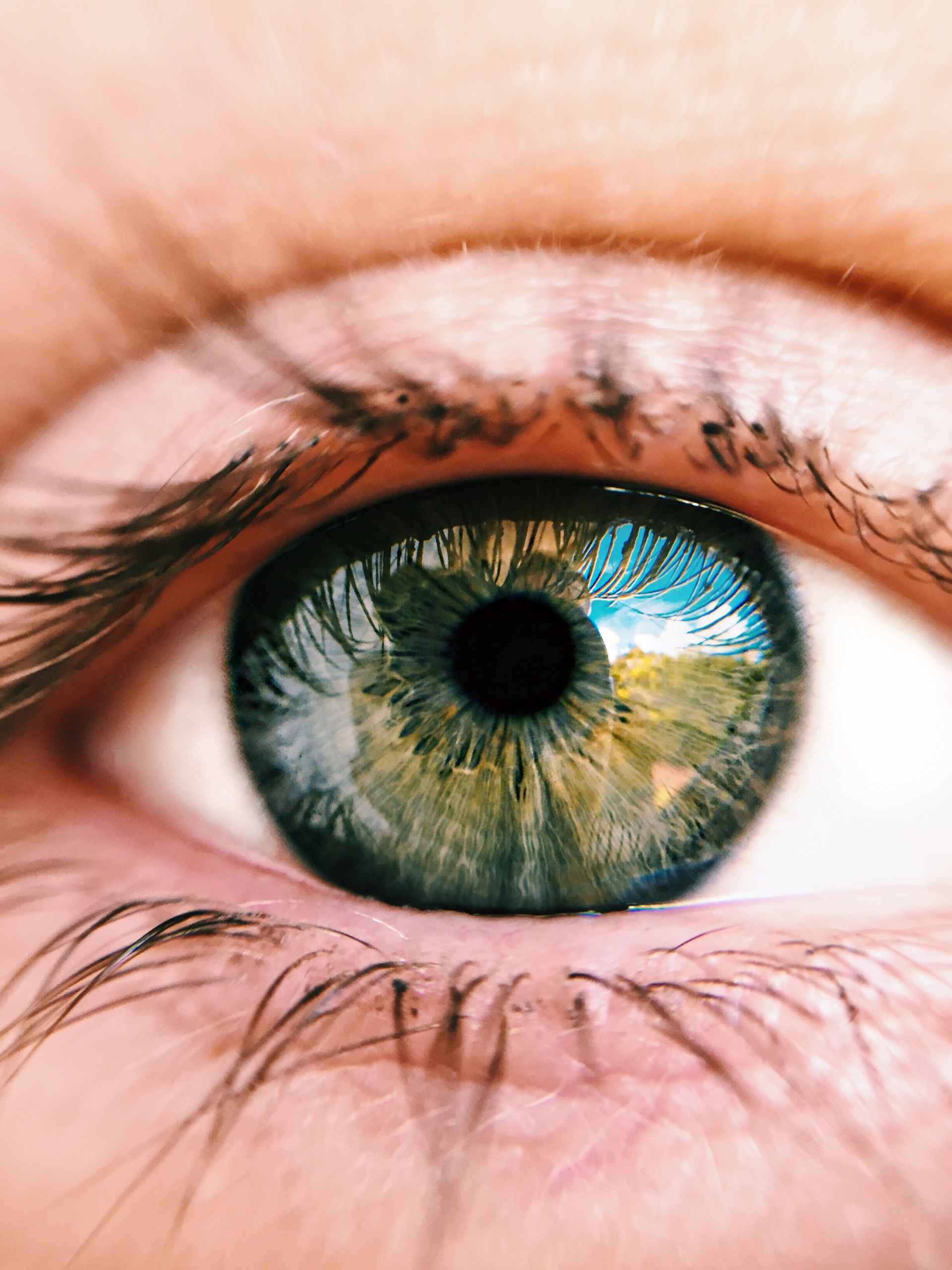 Conjunctivitis