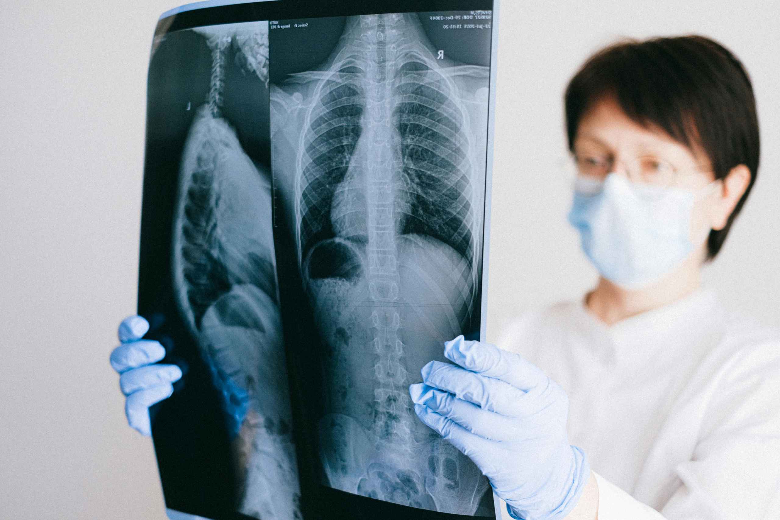 Lung Cancer Treatment in Switzerland: Hope for Recovery in the Heart of Europe