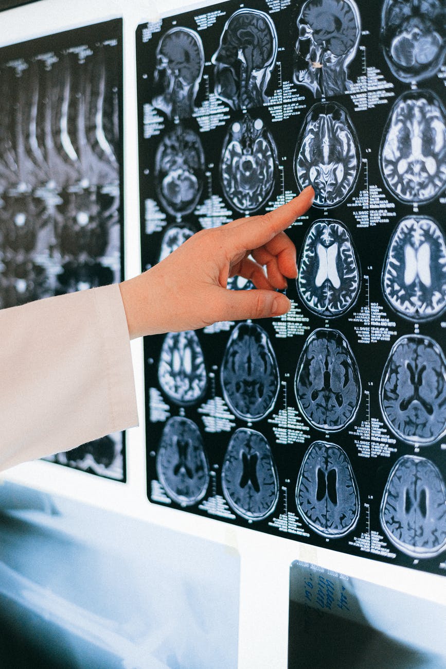 Neurosurgery: Leading Specialists and Clinics in Switzerland