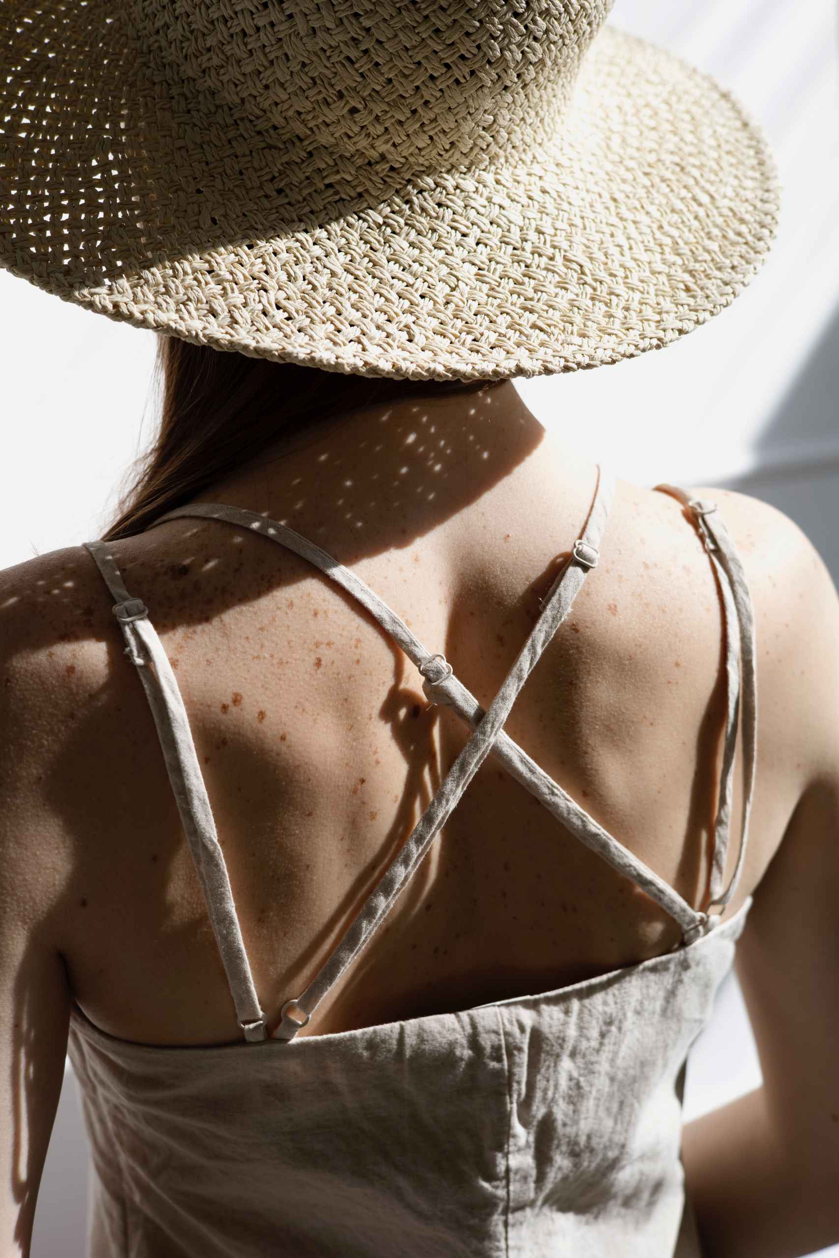 Birthmarks: Are They Dangerous?